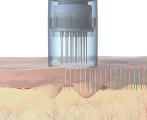 Guía de profundidades del dermapen: qué milímetro usar en cada zona