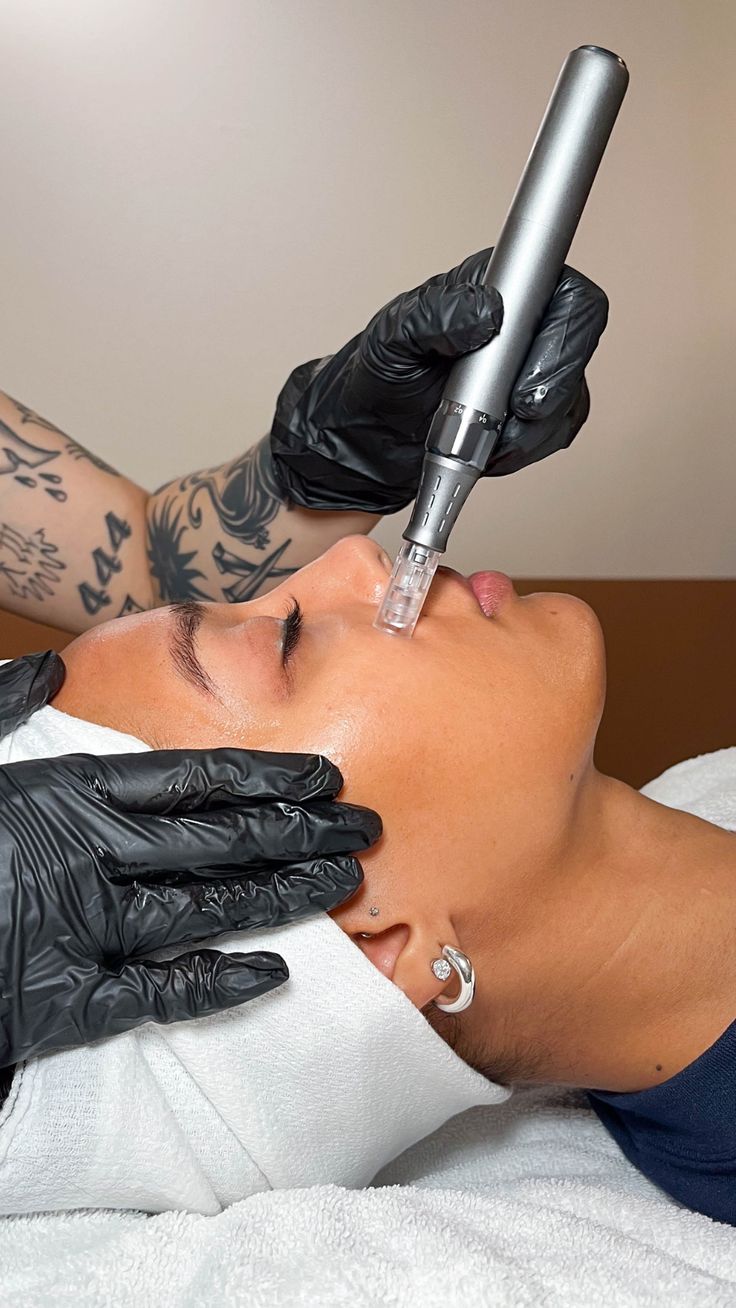 Protocolos de rejuvenecimiento facial con Dr. Pen: guía clínica basada en evidencia